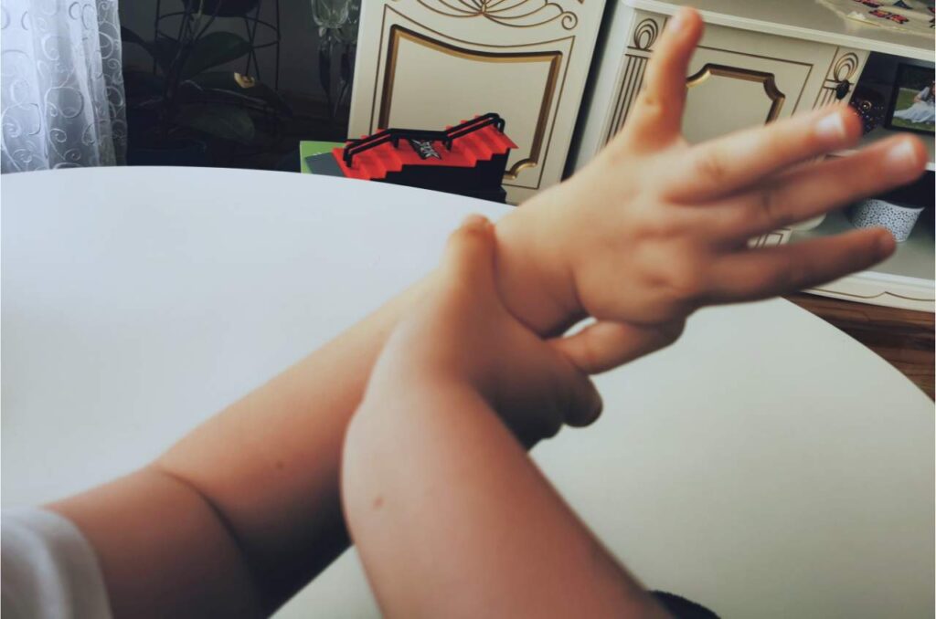 dziecko wygina palce; hipermobilnośc stawowa