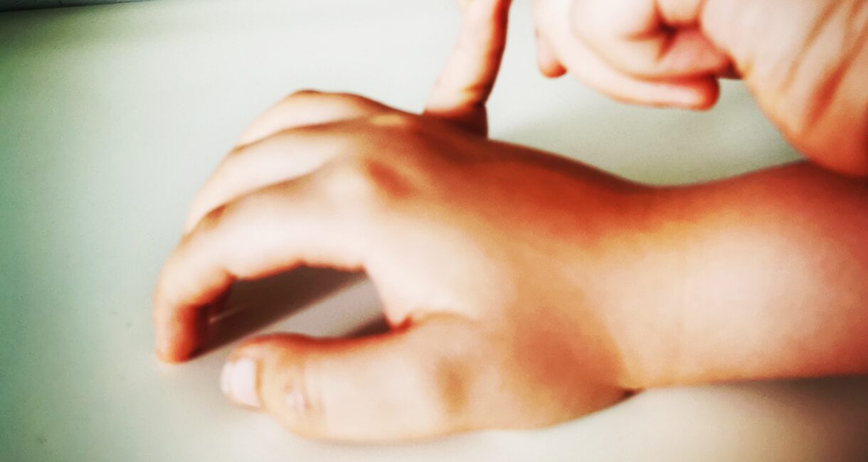 hipermobilność, Wyginanie palców u dzieci, wyginanie dłoni u dzieci, wyginanie łokci u dzieci. Hipermobilność stawowa u dzieci. Kamil Hernoga Fizjoz z głową