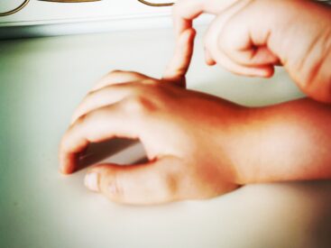 hipermobilność, Wyginanie palców u dzieci, wyginanie dłoni u dzieci, wyginanie łokci u dzieci. Hipermobilność stawowa u dzieci. Kamil Hernoga Fizjoz z głową