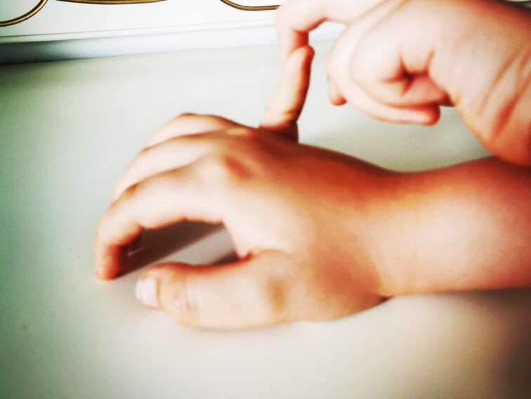 hipermobilność, Wyginanie palców u dzieci, wyginanie dłoni u dzieci, wyginanie łokci u dzieci. Hipermobilność stawowa u dzieci. Kamil Hernoga Fizjoz z głową