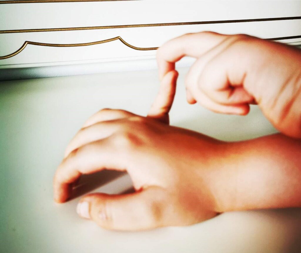 dziecko wygina palce; hipermobilność stawowa