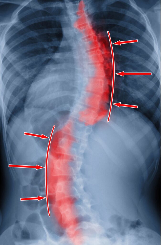 Terapeuta wad postawy Kamil Hernoga - wizyty domowo Otwock, Józefów, Warszawa-Wilanów, Warszawa-Wawer, Warszawa-Ursynów