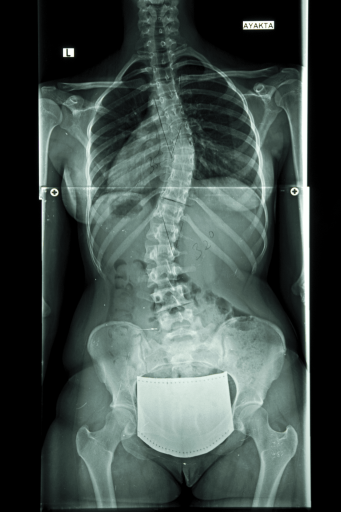 Terapeuta wad postawy Kamil Hernoga - wizyty domowo Otwock, Józefów, Warszawa-Wilanów, Warszawa-Wawer, Warszawa-Ursynów
