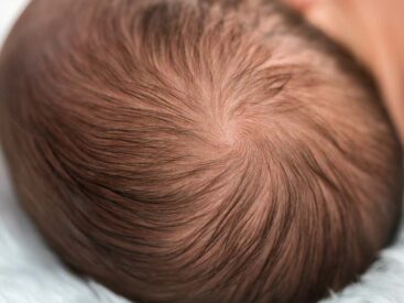 Spłaszczenie główki u niemowlaka, skośnogłowie. Fizjo z Głową Kamil Hernoga