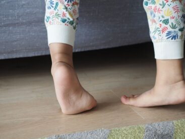 Jakie ćwiczenia na kolana szpotawe u dziecka